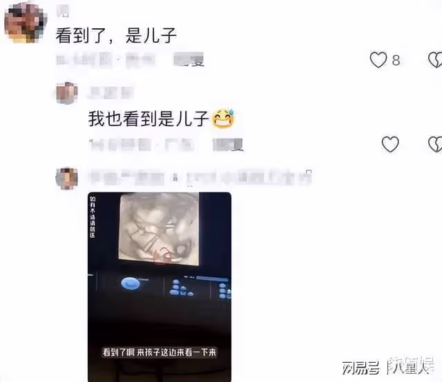 張檬去香港產檢!B超照曝光懷的是男孩,脫鞋測體重拇外翻好嚴重