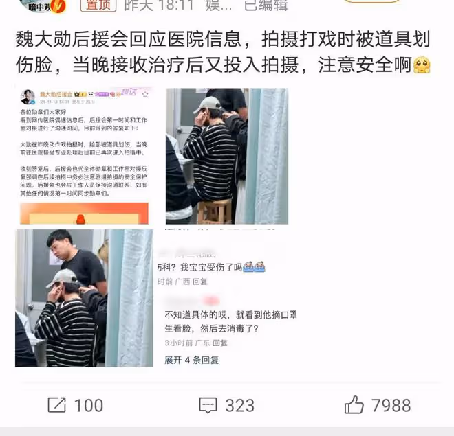 魏大勛拍戲臉部受傷引關注,堅強復工獲贊,粉絲心疼不已