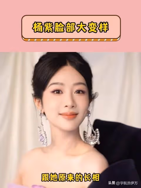 看了這5位明星「換臉史」,不得不信,紅氣養人才是最邪整容術!