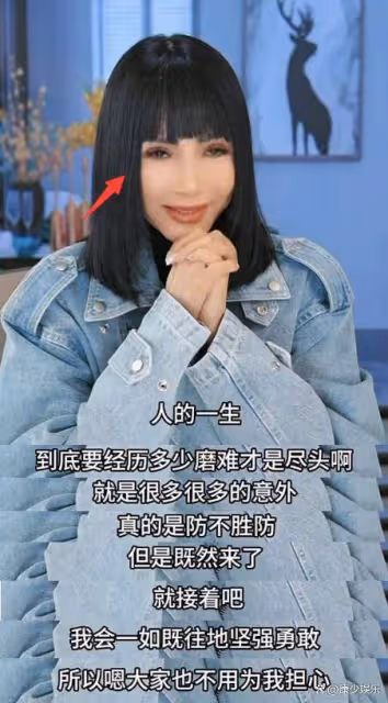 54歲歌手張咪患舌癌,將切掉半個舌頭不能再唱歌了,5年已3次患癌