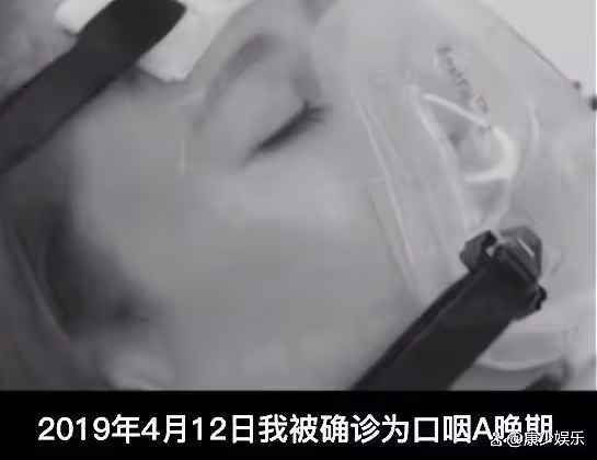 54歲歌手張咪患舌癌,將切掉半個舌頭不能再唱歌了,5年已3次患癌