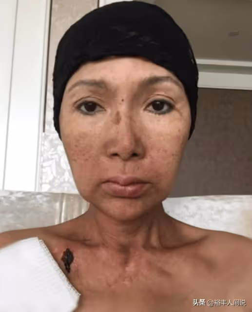 突發!54歲歌手張咪自曝患舌癌,已三度患上癌症,將切掉半邊舌頭