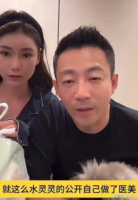 為愛整容!汪小菲為馬筱梅割眼袋,還在恢復期,想喜劇演員變了個人