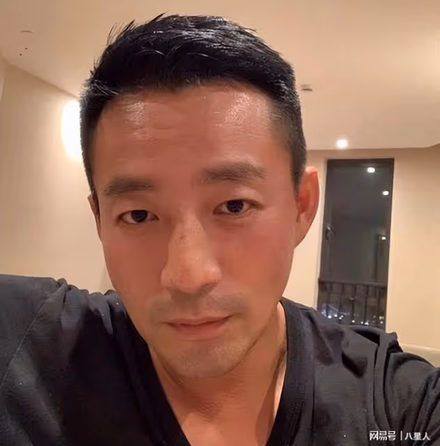 為愛整容!汪小菲為馬筱梅割眼袋,還在恢復期,想喜劇演員變了個人