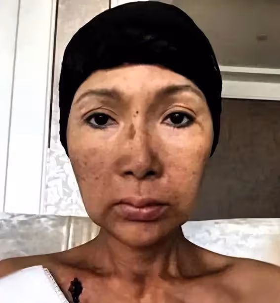 張咪第三次抗癌再戰命運!舌癌確診,她還能再唱動人之歌嗎?