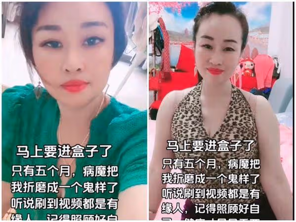 百萬抗癌網紅「年僅53歲離世」!湘妹子生前暴瘦剩35kg 兒慟:沒媽媽了