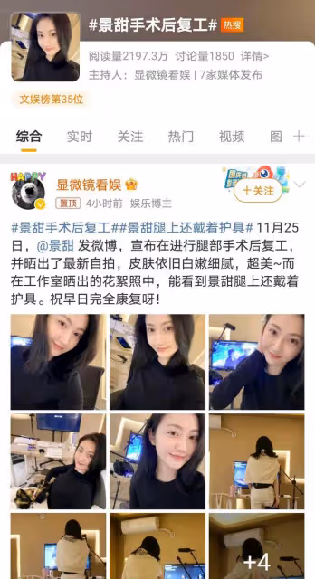 景甜術後不足一月復工配音,敬業美貌雙在線,引髮網友關注