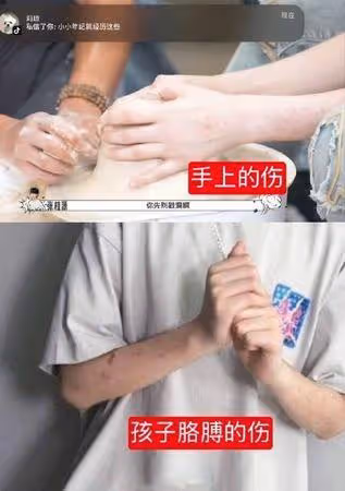 TFBOYS 13歲師弟遭霸凌! 「被按在地上」畫面流出…手上全是傷