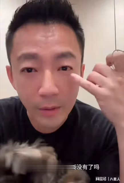 跟馬筱梅一起有壓力!汪小菲整容做醫美改頭換面,整到眼睛都沒了