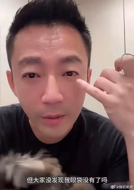 汪小菲補辦婚宴「日期地點」曝!眼腫認整型…妻驚:有人叫你講嗎