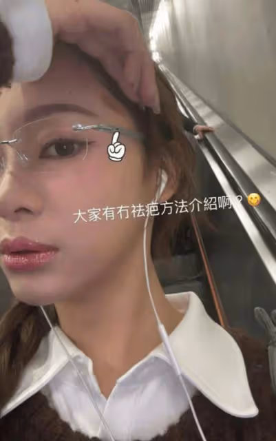 TVB性感小花自爆入行8年戶口僅2位數！直呼還沒用愧對家人！早前又燙傷額頭紅腫一大片
