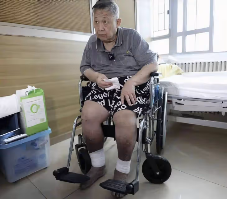 沒錢治病等自愈!TVB老戲骨秦煌雙腳腫脹發黑,一月內兩次跌倒
