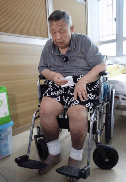 78歲秦煌在廁所摔倒再次入院!又被檢查出心臟問題!大笑稱無懼死亡