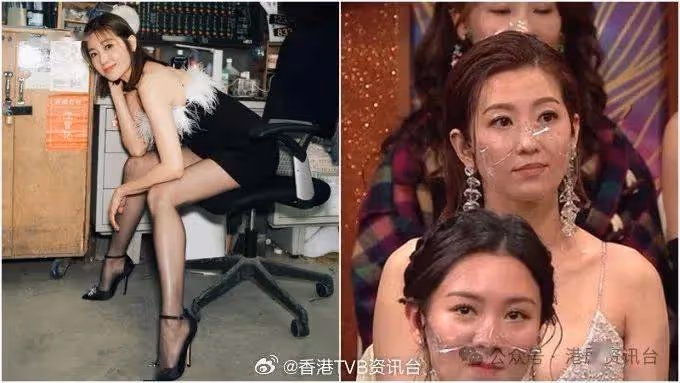 TVB視帝奪「華鼎視帝」又多謝家人!網民又想起陳自瑤敷衍畫面