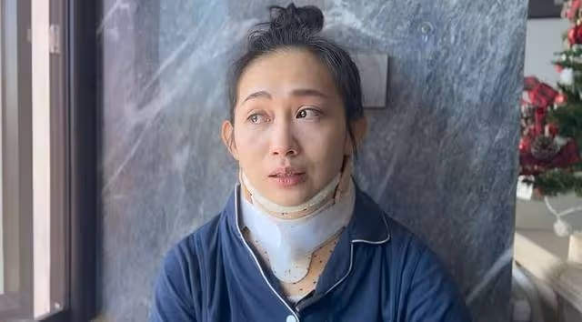 香港知名靚模脖頸嚴重受傷，玩引體向上凌空墜地，隨時可能癱瘓