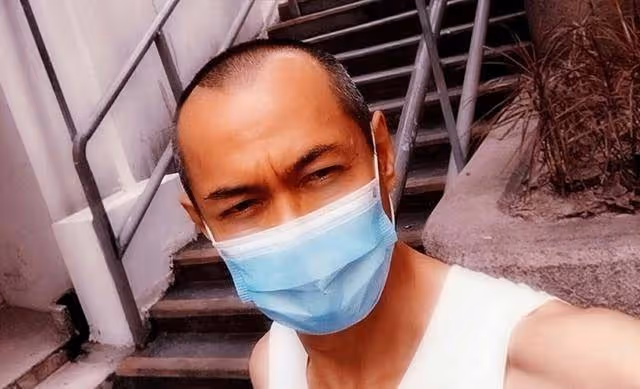 香港知名男星突然變消瘦,深受髮際線後移影響,直接以光頭出鏡