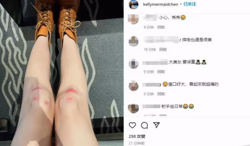 林志穎老婆曬照,40歲依舊美如少女,右腿膝蓋摔傷貼大塊人工皮