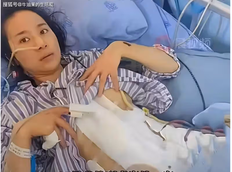 2年被家暴16次,終生掛糞袋女子發聲:願意凈身出戶,只接受死刑