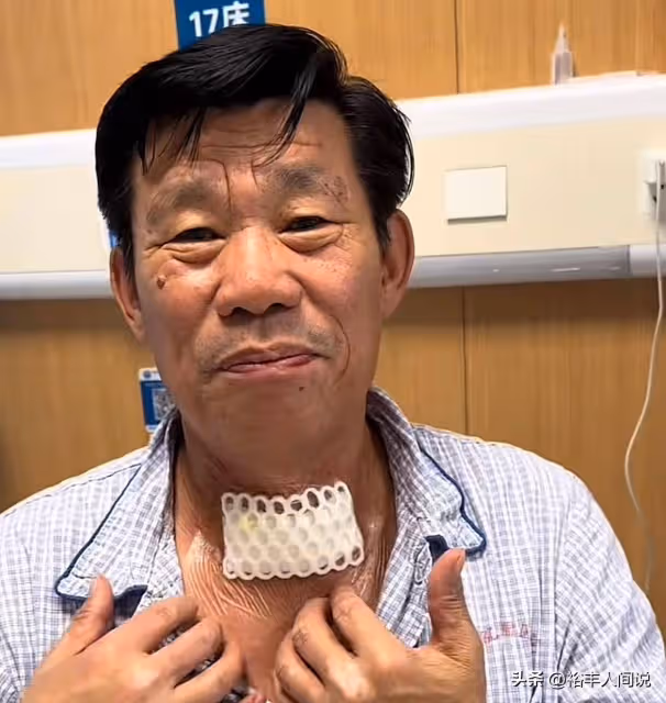 《亮劍》演員楊清文確診癌症!發文透露細節,滿口黃牙遭吐槽