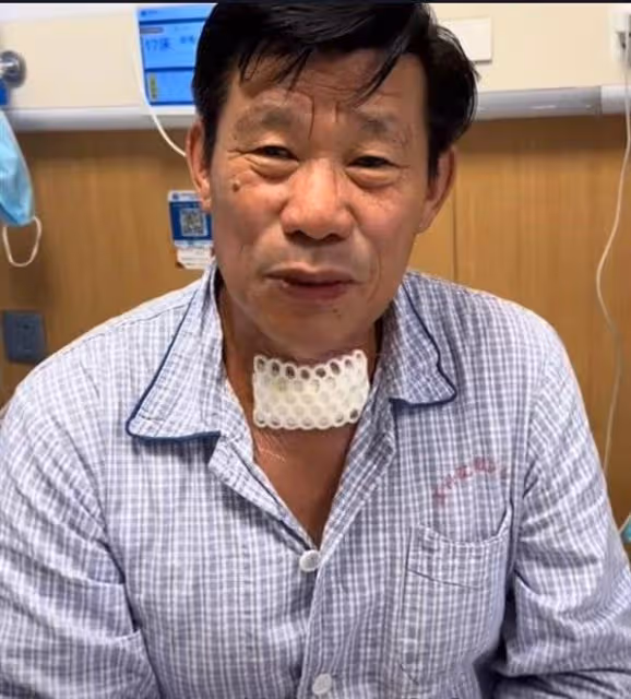 《亮劍》演員楊清文確診甲狀腺癌:已經完成切除手術