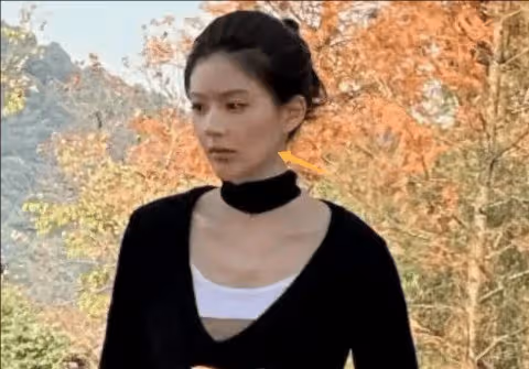 趙露思暫停後續所有工作,趙露思生病很嚴重嗎