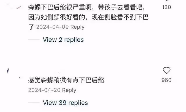 網友幾個月前提醒！森碟下巴後縮嚴重！田亮葉一茜被炮轟不會養女兒