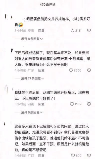 網友幾個月前提醒！森碟下巴後縮嚴重！田亮葉一茜被炮轟不會養女兒