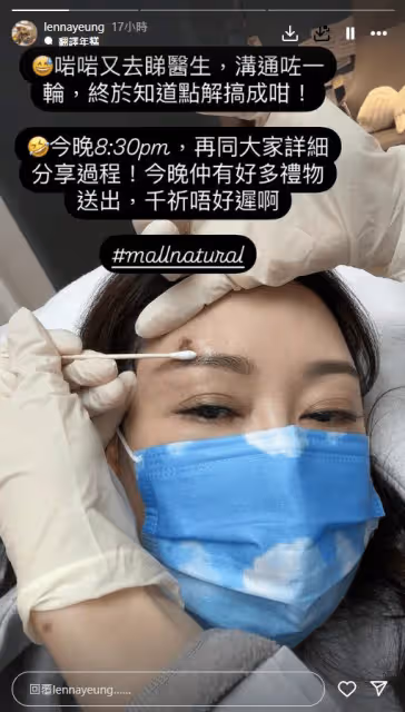 敬業!「最強繼母」楊卓娜受傷仍堅持工作,希望與妹妹能齊頭並進