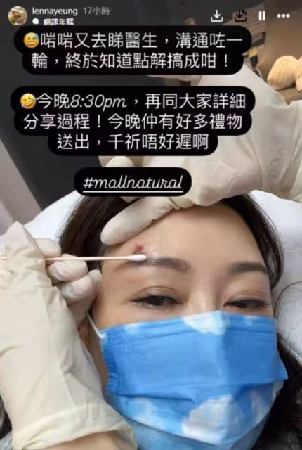 好拼!TVB女星受傷破相堅持開工,未婚生女仍未結婚更甘願當繼母