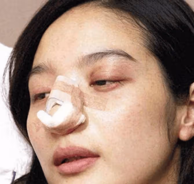 新婚13天他將妻子手指砍斷,虐待至終身不孕,他憑啥回娛樂圈繼續圈錢?