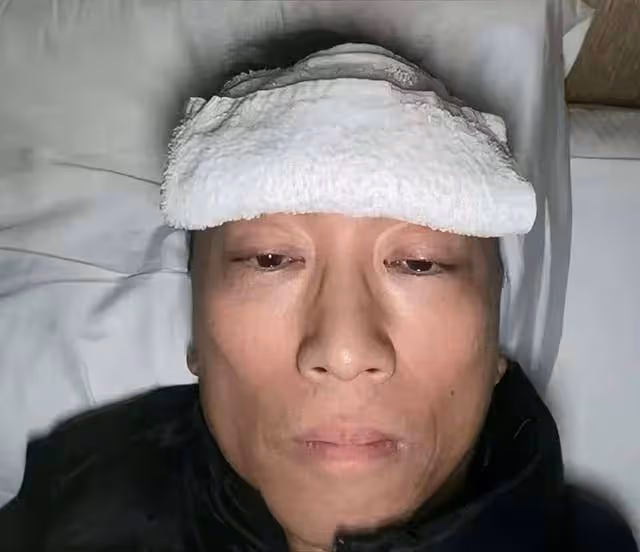 香港知名富商曬患肺炎病照，雙頰凹陷一周瘦10多斤，遭質疑蹭熱度