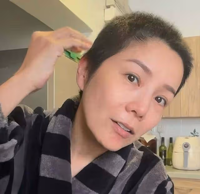 香港女星乳腺癌復發,順利完成細胞免疫治療,經常以光頭形象示人