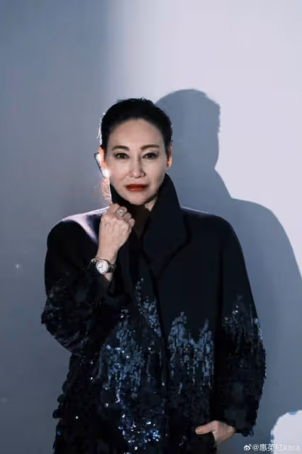 知名港女星公開自己整容內幕！面部多處受傷，縫近百針惹人心疼