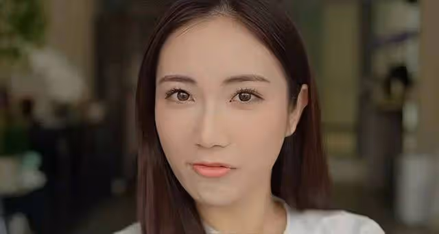 TVB前女星整容醫美長達十年,踏入娛樂圈不自信,打過六種美容針