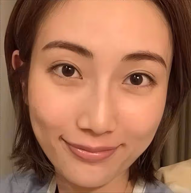 TVB前女星整容醫美長達十年,踏入娛樂圈不自信,打過六種美容針