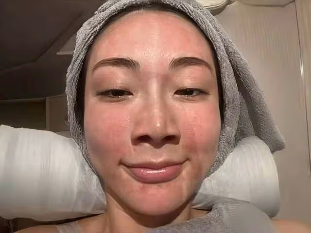 TVB前女星整容醫美長達十年,踏入娛樂圈不自信,打過六種美容針