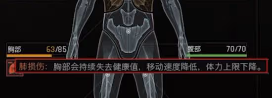《暗區突圍:無限》健康系統機制解讀