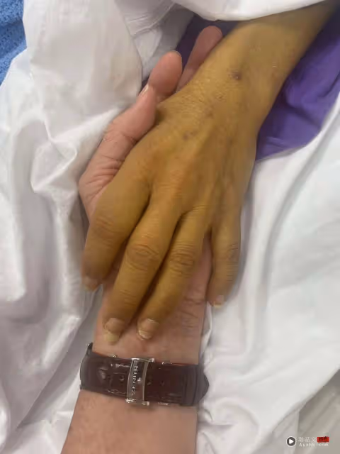 艾威老婆離世 得年61歲！悲痛發文：陽光下再不是兩個人的影子