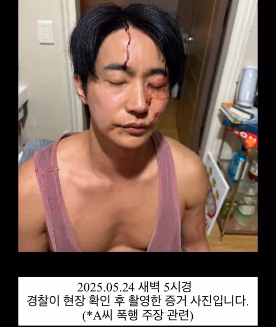 遭前女友控家暴、傳染性病!韓國男星曬爆頭照反擊!