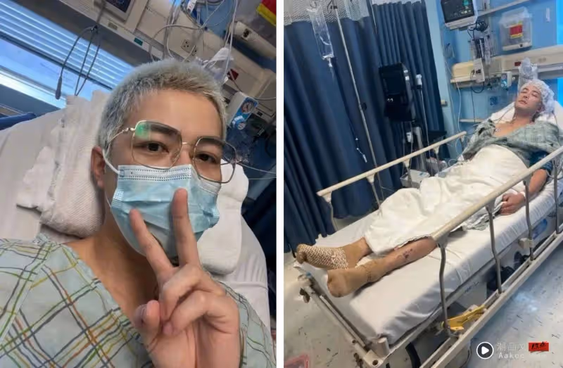2年前遭遇嚴重車禍!左腿打鋼針 陳學冬仍未痊癒:希望是最後一次手術