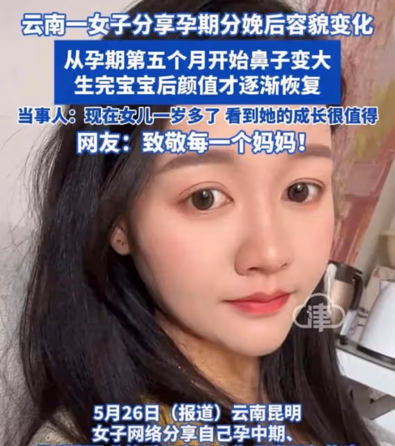女子曬孕前孕後對比照，從懷孕五個月開始變樣，一下子老了三十歲