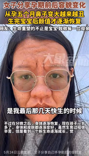 女子曬孕前孕後對比照，從懷孕五個月開始變樣，一下子老了三十歲