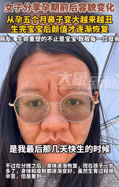 女子曬孕前孕後對比照，從懷孕五個月開始變樣，一下子老了三十歲