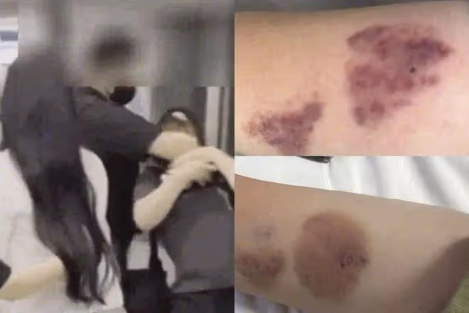 女團安保對粉絲暴力鎖喉致粉絲多處受傷