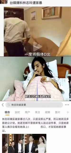 林志玲不斷「倭化」眼神凌厲恐懼慌亂 陳冠希的評價終於有人信了
