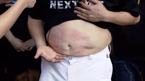 胡瓜大方露肚當財庫! 遭2女星拍打「直接紅腫」錄影畫片曝光