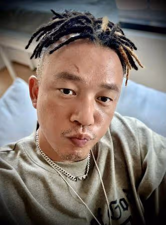 阿Ben拍戲受傷「白衣全是血」! 首曝傷勢照頭縫數針