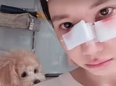 樂天女孩筠熹被愛犬咬破臉蛋破相了！卻被酸民質疑假受傷暴氣反擊