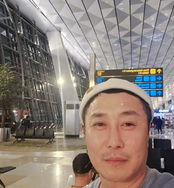 49歲韓男星突爆受傷「緊急皮膚移植」! 才傳婚訊傷勢曝光