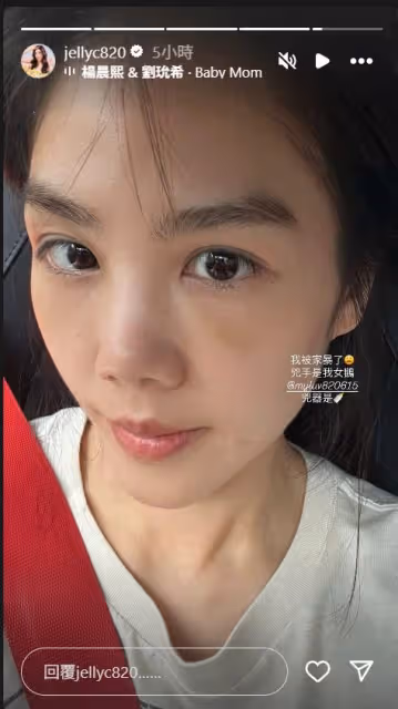 楊晨熙眼下驚現大片瘀青! 揭發「兇手」喊:我被家暴了
